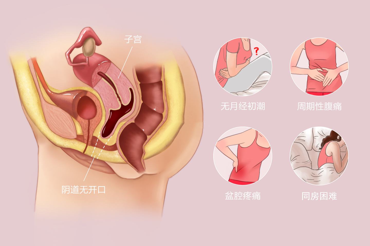 石女的定义与特征，深入了解石女现象及图片展示