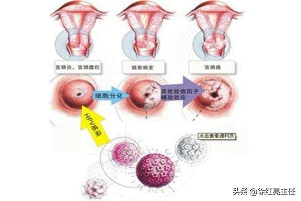 广西壮族自治区病毒感染情况深度分析