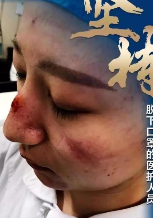 回望武汉疫情起点，挑战与希望的交织时刻（2019年）