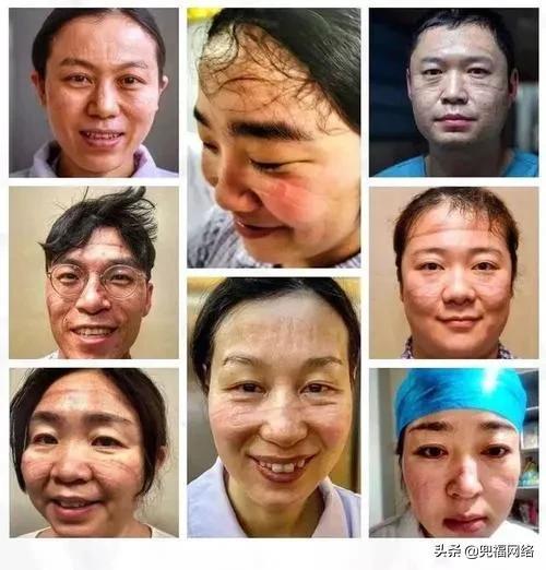 全球新冠疫情结束时间的探讨与预测分析