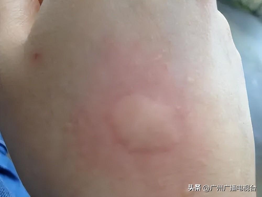广州最新疾病概况概述